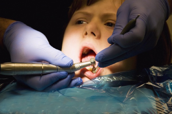 A girl undergoing treatment at the dentist's office;Whitley bay tyne and wear england Dental work on a child