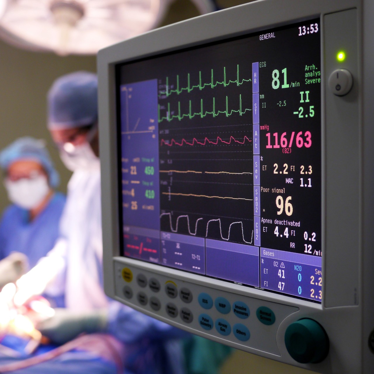 Photo of a heart monitor during surgery, with medical staff slightly visible behind the machine in the background
