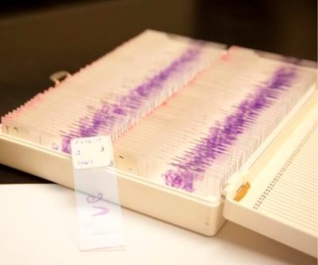 Stained samples on slides