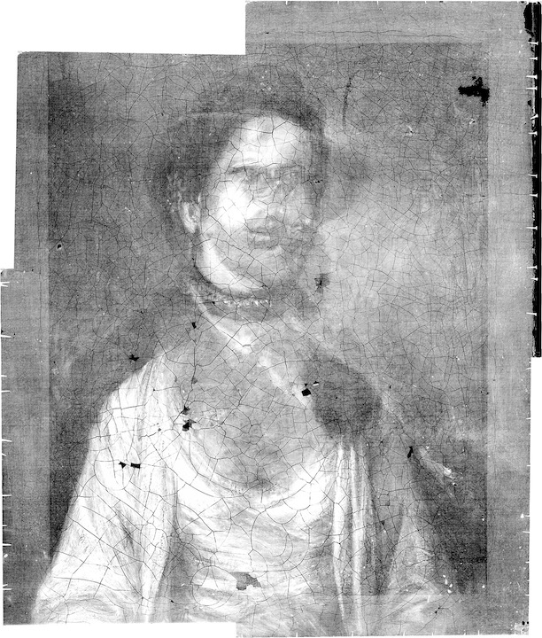 X-radiograph of a woman X-radiograph of a woman