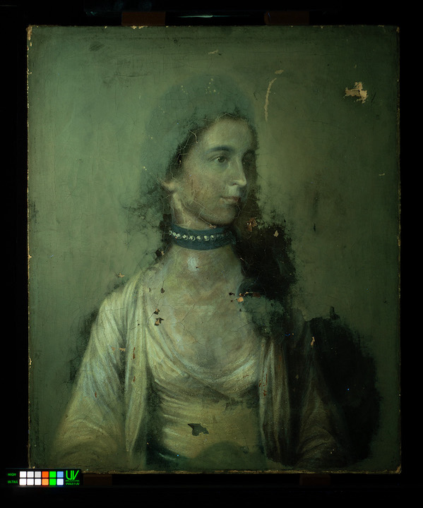 UV-A imaging of a woman UV-A imaging of a woman