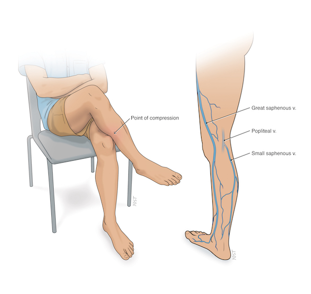 illustration of legs with named parts