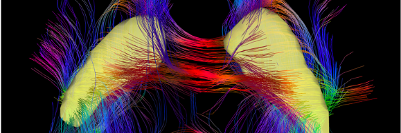 Brain wave image.