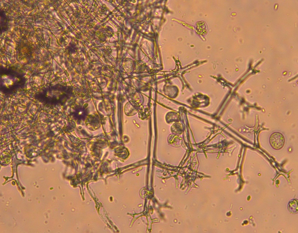 Downy mildew on impatiens cellular level photo Images: N. Gregory, University of Delaware