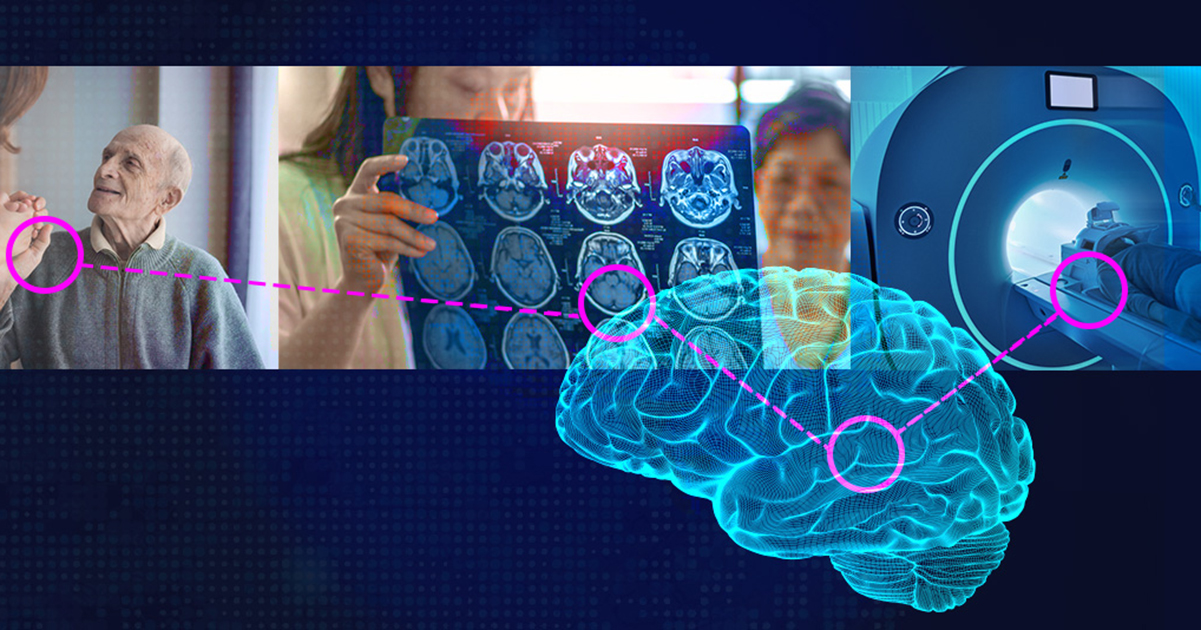 A graphic image aimed at showcasing Alzheimer's research. It includes a photo of an older man on the left, brain scans in the middle, and an MRI machine on the right with an image of a brain overlain on top with connecting dots and dotted lines.