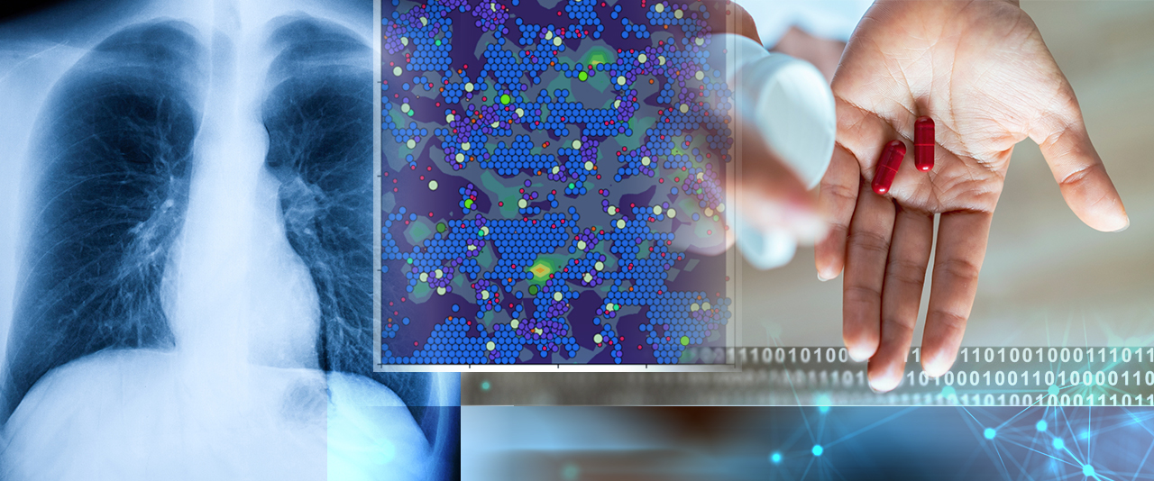 Quantitative systems pharmacology (QSP) combines pharmacokinetics, computational modeling and biological data to understand how drugs and biological processes behave in the body. At top left, a model from Aminul Islam shows SARS-CoV-2 spreading through lung tissue.