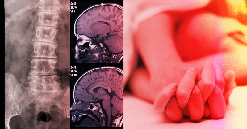 David Tulsky, professor in UD’s Department of Physical Therapy and director of the Center for Health Assessment Research and Translation (CHART), acquired a five-year grant to develop measurement tools to assess sexual functioning in individuals with spinal cord injury and traumatic brain injury.