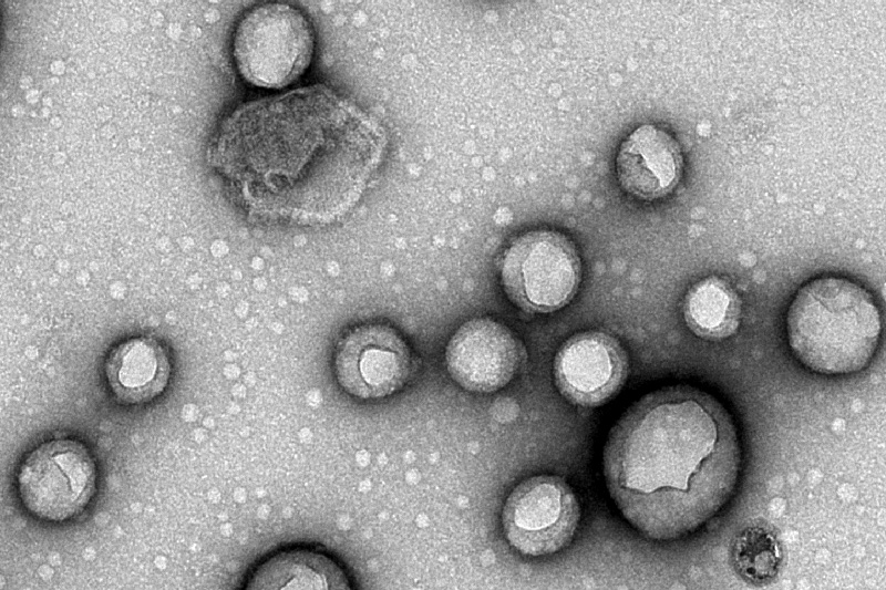 Microscopic image of membrane-wrapped nanoparticles with protein coronas. Microscopic image of membrane-wrapped nanoparticles with protein coronas.