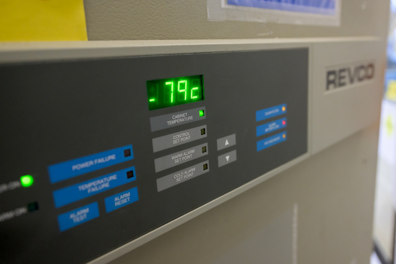 The freezer in Duncan’s laboratory stores tissues that support research into eye development and the side effects of cataract surgery at ultra-low temperatures.